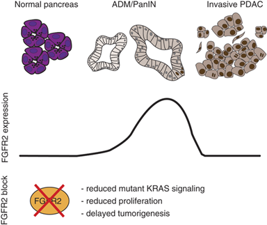 cancer research june 2025